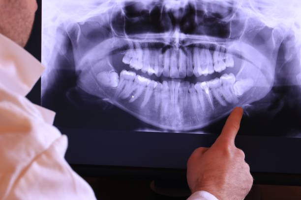 Best Emergency Tooth Extraction in River Grove, IL
