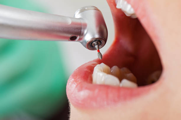 Best Emergency Root Canal Treatment in River Grove, IL